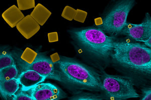 Nanomedicina, una nueva esperanza para un diagnóstico precoz y un tratamiento más efectivo del cáncer