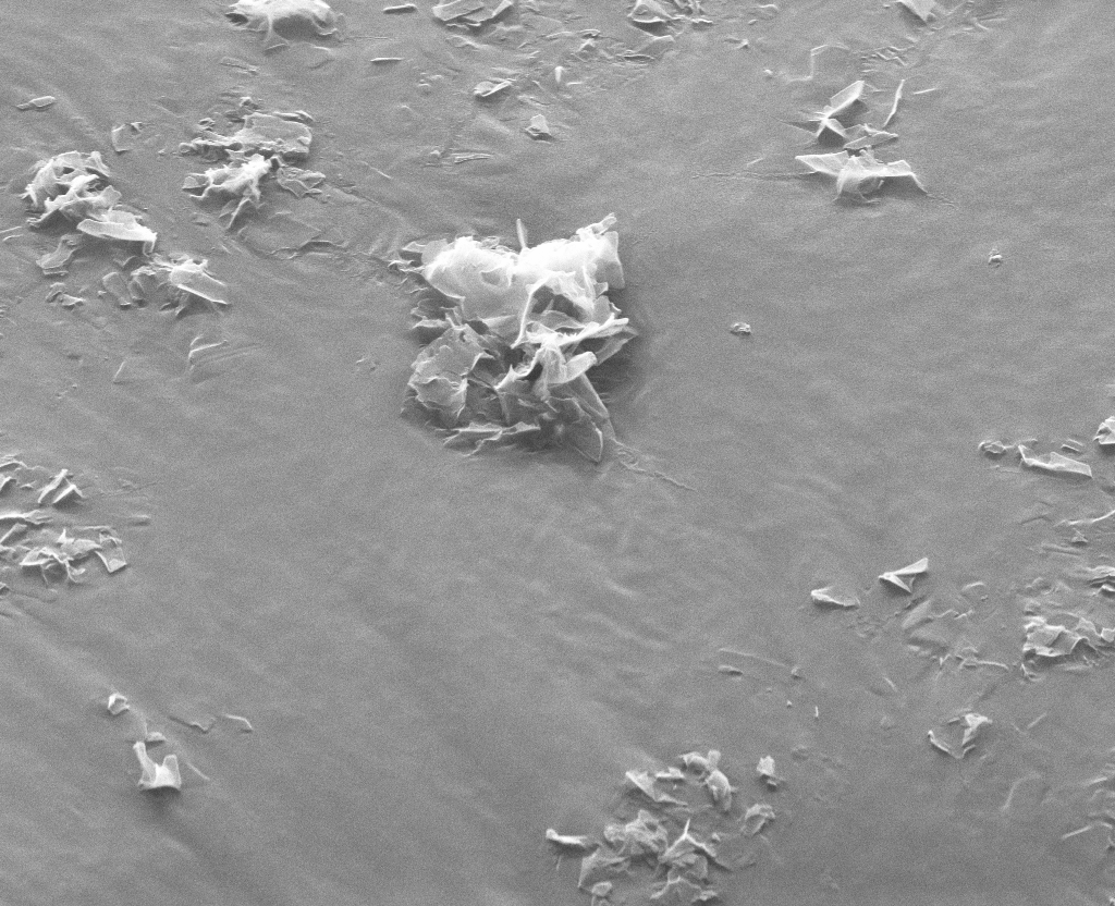 Imagen de microscopia electrónica con material lipídico suplementado con nanopartículas de cobre